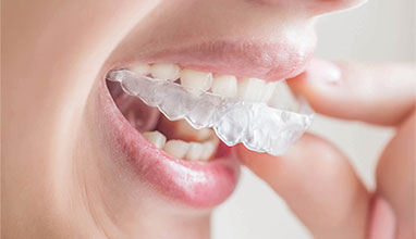 Confidence Boost: The Positive Impact of Invisalign On Aspiring Models