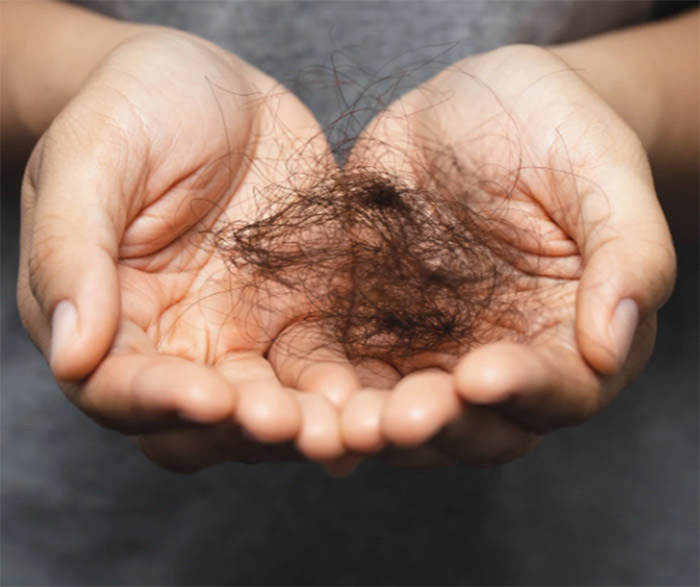 Laser hair removal