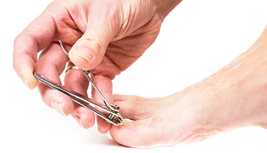 Suffering from Ingrown Toenails? Here’s When You Need Surgery